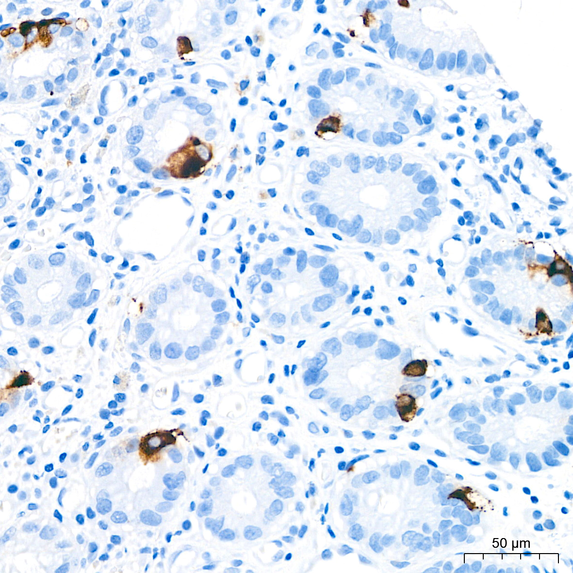 Immunohistochemistry analysis of paraffin-embedded Human colon tissue using Chromogranin A Rabbit mAb at a dilution of 1:4000 (40x lens). High pressure antigen retrieval performed with 0.01M Citrate Buffer (pH 6.0) prior to IHC staining.