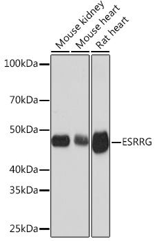 Western blot analysis of various lysates using ESRRG Rabbit mAb at 1:1000 dilution.|Secondary antibody: HRP-conjugated Goat anti-Rabbit IgG (H+L) at 1:10000 dilution.|Lysates/proteins: 25μg per lane.|Blocking buffer: 3% nonfat dry milk in TBST.|Detection: ECL Basic Kit.|Exposure time: 1s.