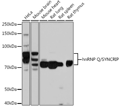 Western blot analysis of various lysates using hnRNP Q/SYNCRIP /SYNCRIP Rabbit mAb at 1:1000 dilution.|Secondary antibody: HRP-conjugated Goat anti-Rabbit IgG (H+L) at 1:10000 dilution.|Lysates/proteins: 25μg per lane.|Blocking buffer: 3% nonfat dry milk in TBST.|Detection: ECL Basic Kit.|Exposure time: 3s.
