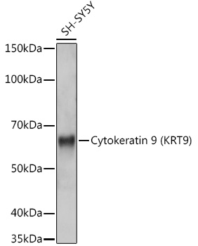 Western blot analysis of lysates from SH-SY5Y cells, using Cytokeratin 9 (KRT9) Rabbit mAb at 1:1000 dilution.|Secondary antibody: HRP-conjugated Goat anti-Rabbit IgG (H+L) at 1:10000 dilution.|Lysates/proteins: 25μg per lane.|Blocking buffer: 3% nonfat dry milk in TBST.|Detection: ECL Basic Kit.|Exposure time: 1s.