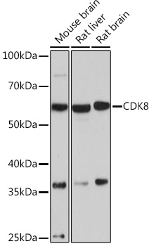 Western blot analysis of various lysates using CDK8 Rabbit mAb at 1:1000 dilution.|Secondary antibody: HRP-conjugated Goat anti-Rabbit IgG (H+L) at 1:10000 dilution.|Lysates/proteins: 25μg per lane.|Blocking buffer: 3% nonfat dry milk in TBST.|Detection: ECL Basic Kit.|Exposure time: 90s.