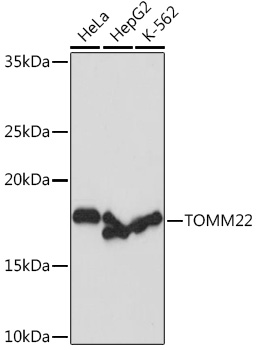 Western blot analysis of lysates from HeLa cells, using TOMM22 Rabbit mAb at 1:1000 dilution.|Secondary antibody: HRP-conjugated Goat anti-Rabbit IgG (H+L) at 1:10000 dilution.|Lysates/proteins: 25μg per lane.|Blocking buffer: 3% nonfat dry milk in TBST.|Detection: ECL Basic Kit.|Exposure time: 1s.
