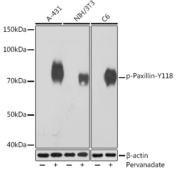 Western blot analysis of various lysates using Phospho-Paxillin-Y118 Rabbit mAb at 1:1000 dilution. A-431 cells were treated with pervanadate (1 mM) at 37℃ for 30 minutes after serum-starvation overnight.  NIH/3T3 cells were treated with pervanadate (1 mM) at 37℃ for 30 minutes after serum-starvation overnight. C6 cells were treated with pervanadate (1 mM) at 37℃ for 30 minutes after serum-starvation overnight.|Secondary antibody: HRP-conjugated Goat anti-Rabbit IgG (H+L) at 1:10000 dilution.|Lysates/proteins: 25μg per lane.|Blocking buffer: 3% BSA.|Detection: ECL Basic Kit.|Exposure time: 1s.