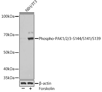 Western blot analysis of various lysates using Phospho-PAK1/2/3-S144/S141/S139 Rabbit mAb at 1:1000 dilution. NIH/3T3 cells were treated with Forskolin (30 uM) at 37℃ for 30 minutes after serum-starvation overnight|Secondary antibody: HRP-conjugated Goat anti-Rabbit IgG (H+L) at 1:10000 dilution.|Lysates/proteins: 25μg per lane.|Blocking buffer: 3% BSA.|Detection: ECL Basic Kit.|Exposure time: 1s.