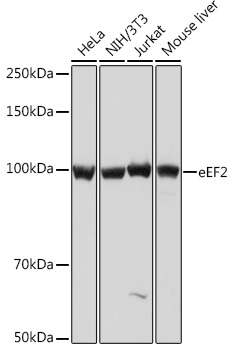 Western blot analysis of various lysates using eEF2 Rabbit mAb at 1:1000 dilution.|Secondary antibody: HRP-conjugated Goat anti-Rabbit IgG (H+L) at 1:10000 dilution.|Lysates/proteins: 25μg per lane.|Blocking buffer: 3% nonfat dry milk in TBST.|Detection: ECL Basic Kit.|Exposure time: 1s.