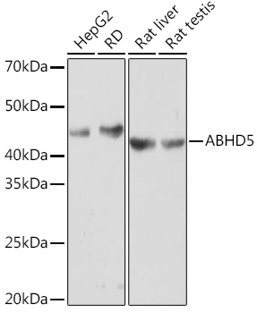 Western blot analysis of various lysates using ABHD5 Rabbit mAb at 1:1000 dilution.|Secondary antibody: HRP-conjugated Goat anti-Rabbit IgG (H+L) at 1:10000 dilution.|Lysates/proteins: 25μg per lane.|Blocking buffer: 3% nonfat dry milk in TBST.|Detection: ECL Basic Kit.|Exposure time: 3min.