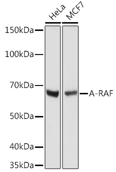 Western blot analysis of various lysates using A-RAF Rabbit mAb at 1:1000 dilution.|Secondary antibody: HRP-conjugated Goat anti-Rabbit IgG (H+L) at 1:10000 dilution.|Lysates/proteins: 25μg per lane.|Blocking buffer: 3% nonfat dry milk in TBST.|Detection: ECL Basic Kit.|Exposure time: 10s.