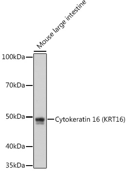 Western blot analysis of lysates from Mouse large intestine, using Cytokeratin 16 (KRT16) Rabbit mAb at 1:1000 dilution.|Secondary antibody: HRP-conjugated Goat anti-Rabbit IgG (H+L) at 1:10000 dilution.|Lysates/proteins: 25μg per lane.|Blocking buffer: 3% nonfat dry milk in TBST.|Detection: ECL Enhanced Kit.|Exposure time: 180s.