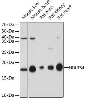 Western blot analysis of various lysates using NDUFS4 Rabbit mAb at 1:1000 dilution.|Secondary antibody: HRP-conjugated Goat anti-Rabbit IgG (H+L) at 1:10000 dilution.|Lysates/proteins: 25μg per lane.|Blocking buffer: 3% nonfat dry milk in TBST.|Detection: ECL Basic Kit.|Exposure time: 30s.