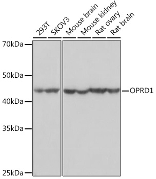 Western blot analysis of various lysates using OPRD1 Rabbit mAb at 1:1000 dilution.|Secondary antibody: HRP-conjugated Goat anti-Rabbit IgG (H+L) at 1:10000 dilution.|Lysates/proteins: 25μg per lane.|Blocking buffer: 3% nonfat dry milk in TBST.|Detection: ECL Basic Kit.|Exposure time: 3s.