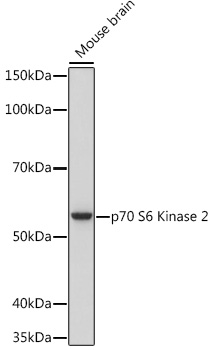 Western blot analysis of lysates from Mouse brain, using p70 S6 Kinase 2 Rabbit mAb at 1:1000 dilution incubated overnight at 4℃.|Secondary antibody: HRP-conjugated Goat anti-Rabbit IgG (H+L) at 1:10000 dilution.|Lysates/proteins: 25 μg per lane.|Blocking buffer: 3% nonfat dry milk in TBST.|Detection: ECL Basic Kit.|Exposure time: 3 s.