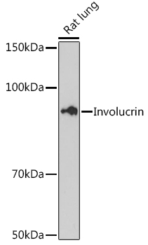 Western blot analysis of lysates from Rat lung, using Involucrin Rabbit mAb at 1:500 dilution.|Secondary antibody: HRP-conjugated Goat anti-Rabbit IgG (H+L) at 1:10000 dilution.|Lysates/proteins: 25μg per lane.|Blocking buffer: 3% nonfat dry milk in TBST.|Detection: ECL Basic Kit.|Exposure time: 180s.