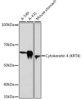 Western blot analysis of various lysates using Cytokeratin 4 (KRT4) (KRT4) Rabbit mAb at 1:1000 dilution.|Secondary antibody: HRP-conjugated Goat anti-Rabbit IgG (H+L) at 1:10000 dilution.|Lysates/proteins: 25μg per lane.|Blocking buffer: 3% nonfat dry milk in TBST.|Detection: ECL Basic Kit.|Exposure time: 30s.