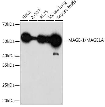 Western blot analysis of various lysates using MAGE-1/MAGE1A Rabbit mAb at 1:1000 dilution.|Secondary antibody: HRP-conjugated Goat anti-Rabbit IgG (H+L) at 1:10000 dilution.|Lysates/proteins: 25μg per lane.|Blocking buffer: 3% nonfat dry milk in TBST.|Detection: ECL Enhanced Kit.|Exposure time: 3min.