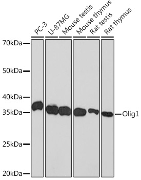 Western blot analysis of various lysates using Olig1 Rabbit mAb at 1:1000 dilution.|Secondary antibody: HRP-conjugated Goat anti-Rabbit IgG (H+L) at 1:10000 dilution.|Lysates/proteins: 25μg per lane.|Blocking buffer: 3% nonfat dry milk in TBST.|Detection: ECL Basic Kit.|Exposure time: 3min.