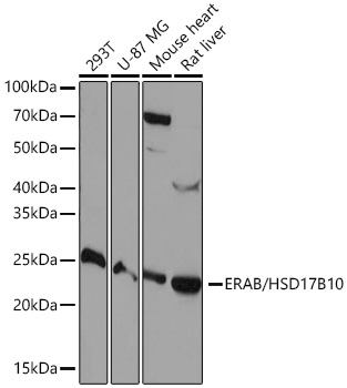 Western blot analysis of various lysates using ERAB/HSD17B10 Rabbit mAb at 1:1000 dilution.|Secondary antibody: HRP-conjugated Goat anti-Rabbit IgG (H+L) at 1:10000 dilution.|Lysates/proteins: 25μg per lane.|Blocking buffer: 3% nonfat dry milk in TBST.|Detection: ECL Basic Kit.|Exposure time: 10s.