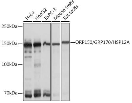 Western blot analysis of various lysates using ORP150/GRP170/HSP12A Rabbit mAb at 1:1000 dilution.|Secondary antibody: HRP-conjugated Goat anti-Rabbit IgG (H+L) at 1:10000 dilution.|Lysates/proteins: 25μg per lane.|Blocking buffer: 3% nonfat dry milk in TBST.|Detection: ECL Basic Kit.|Exposure time: 1s.