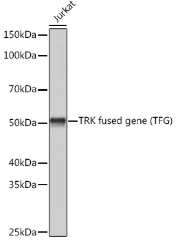 Western blot analysis of lysates from Jurkat cells, using TRK fused gene (TFG) (TFG) Rabbit mAb at 1:3000 dilution.|Secondary antibody: HRP-conjugated Goat anti-Rabbit IgG (H+L) at 1:10000 dilution.|Lysates/proteins: 25μg per lane.|Blocking buffer: 3% nonfat dry milk in TBST.|Detection: ECL Basic Kit.|Exposure time: 1s.