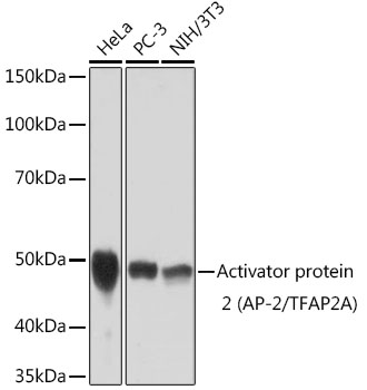 Western blot analysis of various lysates using Activator protein 2 Rabbit mAb at 1:1000 dilution.|Secondary antibody: HRP-conjugated Goat anti-Rabbit IgG (H+L) at 1:10000 dilution.|Lysates/proteins: 25μg per lane.|Blocking buffer: 3% nonfat dry milk in TBST.|Detection: ECL Basic Kit.|Exposure time: 3min.