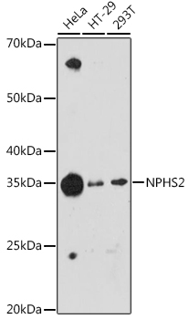 Western blot analysis of various lysates using NPHS2 Rabbit mAb at 1:1000 dilution.|Secondary antibody: HRP-conjugated Goat anti-Rabbit IgG (H+L) at 1:10000 dilution.|Lysates/proteins: 25μg per lane.|Blocking buffer: 3% nonfat dry milk in TBST.|Detection: ECL Enhanced Kit.|Exposure time: 180s.