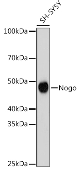 Western blot analysis of lysates from SH-SY5Y cells, using Nogo Rabbit mAb at 1:500 dilution.|Secondary antibody: HRP-conjugated Goat anti-Rabbit IgG (H+L) at 1:10000 dilution.|Lysates/proteins: 25μg per lane.|Blocking buffer: 3% nonfat dry milk in TBST.|Detection: ECL Basic Kit.|Exposure time: 180s.