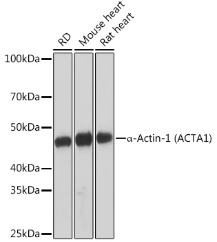 Western blot analysis of lysates from various s, using α-Actin-1 (α-SMA)  Rabbit mAb at 1:1000 dilution.|Secondary antibody: HRP-conjugated Goat anti-Rabbit IgG (H+L) at 1:10000 dilution.|Lysates/proteins: 25μg  per lane.|Blocking buffer: 3% nonfat dry milk in TBST.|Detection: ECL Basic Kit.|Exposure time: 1s.