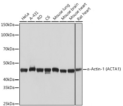 Western blot analysis of various lysates using α-Actin-1 Rabbit mAb at 1:1000 dilution.|Secondary antibody: HRP-conjugated Goat anti-Rabbit IgG (H+L) at 1:10000 dilution.|Lysates/proteins: 25μg per lane.|Blocking buffer: 3% nonfat dry milk in TBST.|Detection: ECL Basic Kit.|Exposure time: 1s.