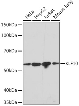 Western blot analysis of various lysates using KLF10 Rabbit mAb at 1:1000 dilution.|Secondary antibody: HRP-conjugated Goat anti-Rabbit IgG (H+L) at 1:10000 dilution.|Lysates/proteins: 25μg per lane.|Blocking buffer: 3% nonfat dry milk in TBST.|Detection: ECL Basic Kit.|Exposure time: 3min.