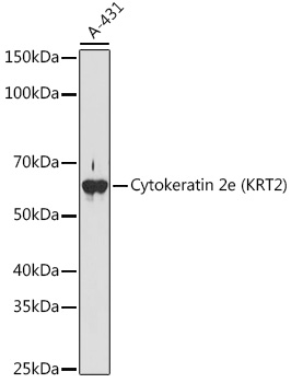 Western blot analysis of lysates from A-431 cells, using Cytokeratin 2e (KRT2) Rabbit mAb at 1:1000 dilution.|Secondary antibody: HRP-conjugated Goat anti-Rabbit IgG (H+L) at 1:10000 dilution.|Lysates/proteins: 25μg per lane.|Blocking buffer: 3% nonfat dry milk in TBST.|Detection: ECL Basic Kit.|Exposure time: 180s.