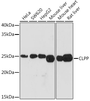 Western blot analysis of various lysates using CLPP Rabbit mAb at 1:1000 dilution.|Secondary antibody: HRP-conjugated Goat anti-Rabbit IgG (H+L) at 1:10000 dilution.|Lysates/proteins: 25μg per lane.|Blocking buffer: 3% nonfat dry milk in TBST.|Detection: ECL Basic Kit.|Exposure time: 3min.