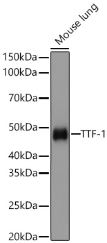 Western blot analysis of lysates from Mouse lung using TTF-1 Rabbit mAb at 1:1000 dilution incubated overnight at 4℃.|Secondary antibody: HRP-conjugated Goat anti-Rabbit IgG (H+L) at 1:10000 dilution.|Lysates/proteins: 25 μg per lane.|Blocking buffer: 3% nonfat dry milk in TBST.|Detection: ECL Basic Kit.|Exposure time: 1s.
