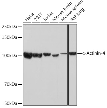 Western blot analysis of various lysates using α-Actinin-4 Rabbit mAb at 1:1000 dilution.|Secondary antibody: HRP-conjugated Goat anti-Rabbit IgG (H+L) at 1:10000 dilution.|Lysates/proteins: 25μg per lane.|Blocking buffer: 3% nonfat dry milk in TBST.|Detection: ECL Basic Kit.|Exposure time: 30s.