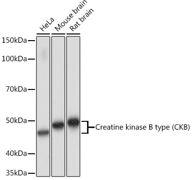 Western blot analysis of various lysates using Creatine kinase B type (CKB) Rabbit mAb at 1:1000 dilution.|Secondary antibody: HRP-conjugated Goat anti-Rabbit IgG (H+L) at 1:10000 dilution.|Lysates/proteins: 25μg per lane.|Blocking buffer: 3% nonfat dry milk in TBST.|Detection: ECL Basic Kit.|Exposure time: 90s.