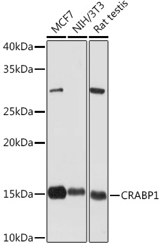 Western blot analysis of various lysates using CRABP1 Rabbit mAb at 1:1000 dilution.|Secondary antibody: HRP-conjugated Goat anti-Rabbit IgG (H+L) at 1:10000 dilution.|Lysates/proteins: 25μg per lane.|Blocking buffer: 3% nonfat dry milk in TBST.|Detection: ECL Basic Kit.|Exposure time: 30s.