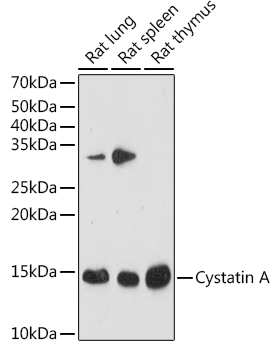 Western blot analysis of various lysates using Cystatin A Rabbit mAb at 1:1000 dilution.|Secondary antibody: HRP-conjugated Goat anti-Rabbit IgG (H+L) at 1:10000 dilution.|Lysates/proteins: 25μg per lane.|Blocking buffer: 3% nonfat dry milk in TBST.|Detection: ECL Enhanced Kit.|Exposure time: 180s.