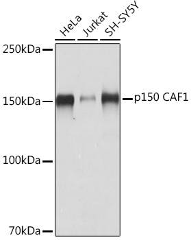 Western blot analysis of various lysates using p150 CAF1 Rabbit mAb at 1:1000 dilution.|Secondary antibody: HRP-conjugated Goat anti-Rabbit IgG (H+L) at 1:10000 dilution.|Lysates/proteins: 25μg per lane.|Blocking buffer: 3% nonfat dry milk in TBST.|Detection: ECL Basic Kit.|Exposure time: 3s.