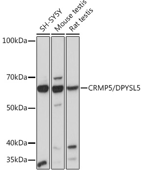 Western blot analysis of various lysates using CRMP5/DPYSL5 Rabbit mAb at 1:1000 dilution.|Secondary antibody: HRP-conjugated Goat anti-Rabbit IgG (H+L) at 1:10000 dilution.|Lysates/proteins: 25μg per lane.|Blocking buffer: 3% nonfat dry milk in TBST.|Detection: ECL Basic Kit.|Exposure time: 10s.