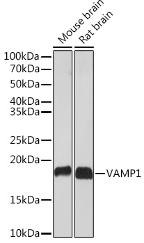 Western blot analysis of various lysates using VAMP1 Rabbit mAb at 1:1000 dilution.|Secondary antibody: HRP-conjugated Goat anti-Rabbit IgG (H+L) at 1:10000 dilution.|Lysates/proteins: 25μg per lane.|Blocking buffer: 3% nonfat dry milk in TBST.|Detection: ECL Basic Kit.|Exposure time: 30s.