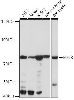 Western blot analysis of various lysates using MELK Rabbit mAb at 1:1000 dilution.|Secondary antibody: HRP-conjugated Goat anti-Rabbit IgG (H+L) at 1:10000 dilution.|Lysates/proteins: 25μg per lane.|Blocking buffer: 3% nonfat dry milk in TBST.|Detection: ECL Basic Kit.|Exposure time: 60s.