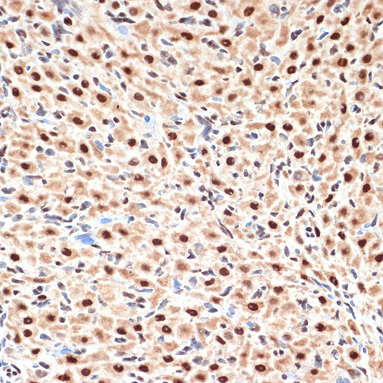 Immunohistochemistry analysis of paraffin-embedded Rat ovary using CDC16 Rabbit mAb at dilution of 1:100 (40x lens). Microwave antigen retrieval performed with 0.01M Tris/EDTA Buffer (pH 9.0) prior to IHC staining.