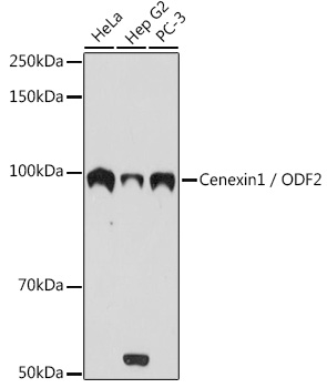Western blot analysis of various lysates using Cenexin1 / ODF2 Rabbit mAb at 1:1000 dilution.|Secondary antibody: HRP-conjugated Goat anti-Rabbit IgG (H+L) at 1:10000 dilution.|Lysates/proteins: 25μg per lane.|Blocking buffer: 3% nonfat dry milk in TBST.|Detection: ECL Basic Kit.|Exposure time: 10s.