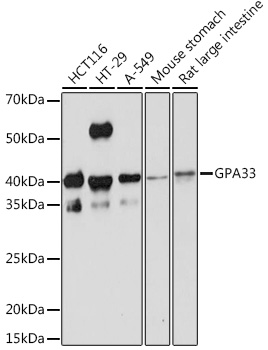 Western blot analysis of various lysates using GPA33 Rabbit mAb at 1:1000 dilution.|Secondary antibody: HRP-conjugated Goat anti-Rabbit IgG (H+L) at 1:10000 dilution.|Lysates/proteins: 25μg per lane.|Blocking buffer: 3% nonfat dry milk in TBST.|Detection: ECL Basic Kit.|Exposure time: 1min.