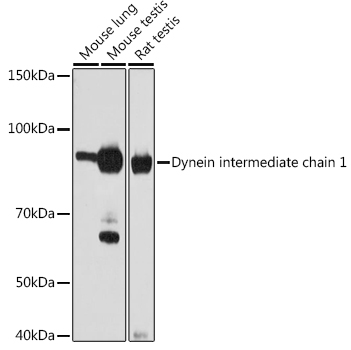 Western blot analysis of various lysates using Dynein intermediate chain 1 Rabbit mAb at 1:1000 dilution incubated overnight at 4°C.|Secondary antibody: HRP-conjugated Goat anti-Rabbit IgG (H+L) at 1:10000 dilution.|Lysates/proteins: 25 μg per lane.|Blocking buffer: 3% nonfat dry milk in TBST.|Detection: ECL Basic Kit.|Exposure time: 60 s.