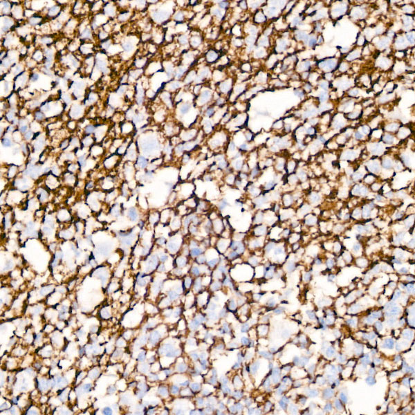 Immunohistochemistry analysis of paraffin-embedded Human tonsil using CD35/CR1 Rabbit mAb at dilution of 1:50 (40x lens). High pressure antigen retrieval performed with 0.01M Citrate buffer (pH 6.0) prior to IHC staining.