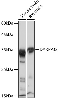 Western blot analysis of various lysates using DARPP32 Rabbit mAb at 1:1000 dilution.|Secondary antibody: HRP-conjugated Goat anti-Rabbit IgG (H+L) at 1:10000 dilution.|Lysates/proteins: 25μg per lane.|Blocking buffer: 3% nonfat dry milk in TBST.|Detection: ECL Basic Kit.|Exposure time: 1s.