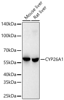 Western blot analysis of various lysates using CYP26A1 Rabbit mAb at 1:1000 dilution incubated at room temperature for 1.5 hours.|Secondary antibody: HRP-conjugated Goat anti-Rabbit IgG (H+L) at 1:10000 dilution.|Lysates/proteins: 25 μg per lane.|Blocking buffer: 3% nonfat dry milk in TBST.|Detection: ECL Basic Kit.|Exposure time: 90 s.