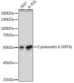 Western blot analysis of various lysates using Cytokeratin 6 (KRT6) (KRT6) Rabbit mAb at 1:3000 dilution.|Secondary antibody: HRP-conjugated Goat anti-Rabbit IgG (H+L) at 1:10000 dilution.|Lysates/proteins: 25μg per lane.|Blocking buffer: 3% nonfat dry milk in TBST.|Detection: ECL Basic Kit.|Exposure time: 1s.