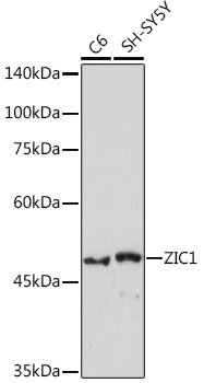 Western blot analysis of various lysates using ZIC1 Rabbit mAb at 1:1000 dilution.|Secondary antibody: HRP-conjugated Goat anti-Rabbit IgG (H+L) at 1:10000 dilution.|Lysates/proteins: 25μg per lane.|Blocking buffer: 3% nonfat dry milk in TBST.|Detection: ECL Basic Kit.|Exposure time: 180s.