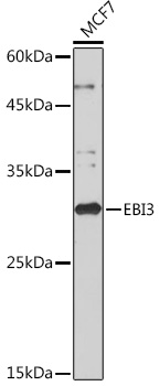 Western blot analysis of lysates from MCF7 cells, using EBI3 Rabbit mAb at 1:1000 dilution.|Secondary antibody: HRP-conjugated Goat anti-Rabbit IgG (H+L) at 1:10000 dilution.|Lysates/proteins: 25μg per lane.|Blocking buffer: 3% nonfat dry milk in TBST.|Detection: ECL Basic Kit.|Exposure time: 10s.