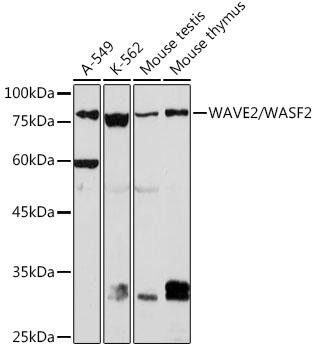 Western blot analysis of various lysates using WAVE2/WASF2 Rabbit mAb at 1:1000 dilution.|Secondary antibody: HRP-conjugated Goat anti-Rabbit IgG (H+L) at 1:10000 dilution.|Lysates/proteins: 25μg per lane.|Blocking buffer: 3% nonfat dry milk in TBST.|Detection: ECL Basic Kit.|Exposure time: 180s.